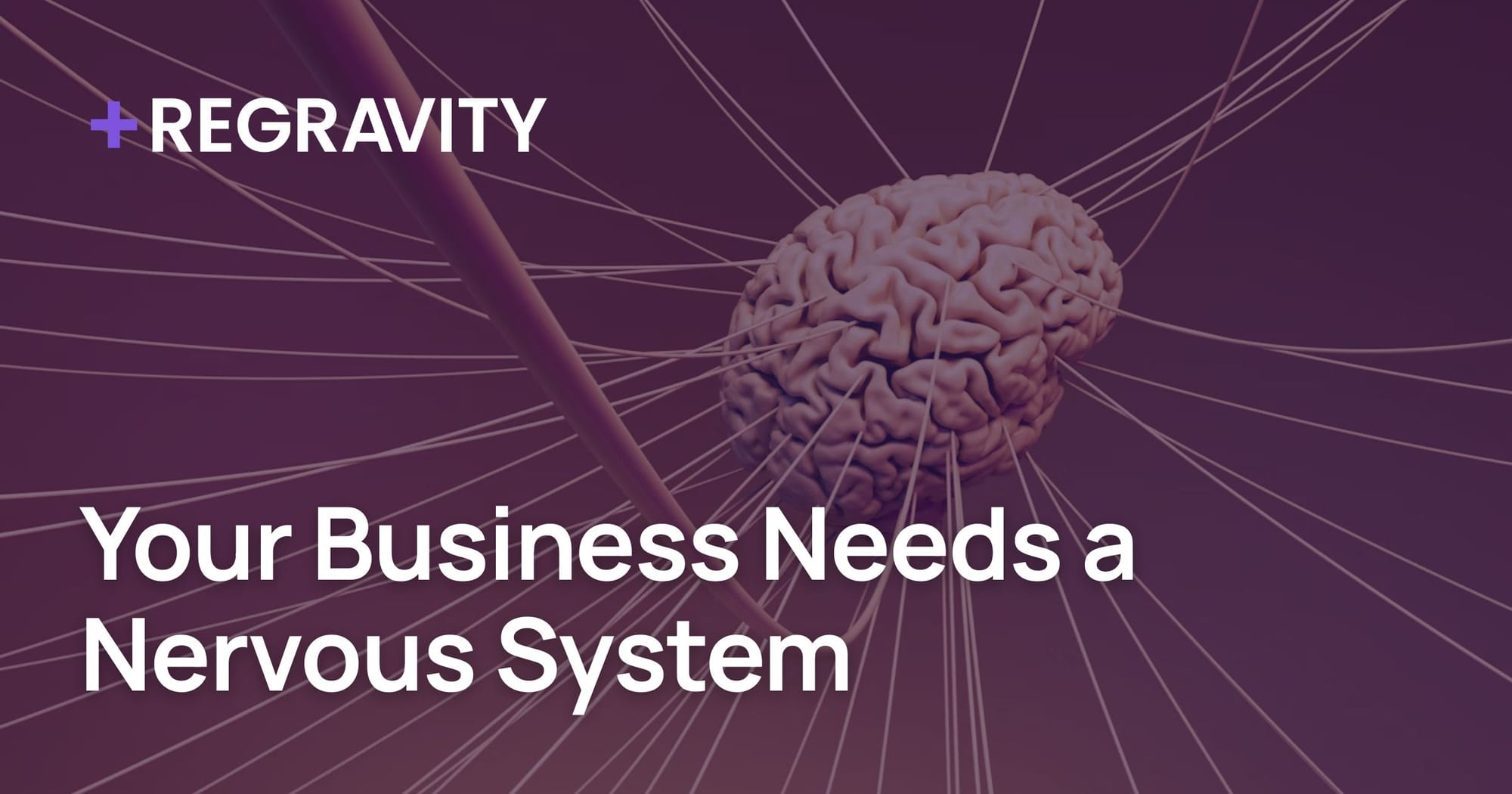 Your Business Needs a Nervous System